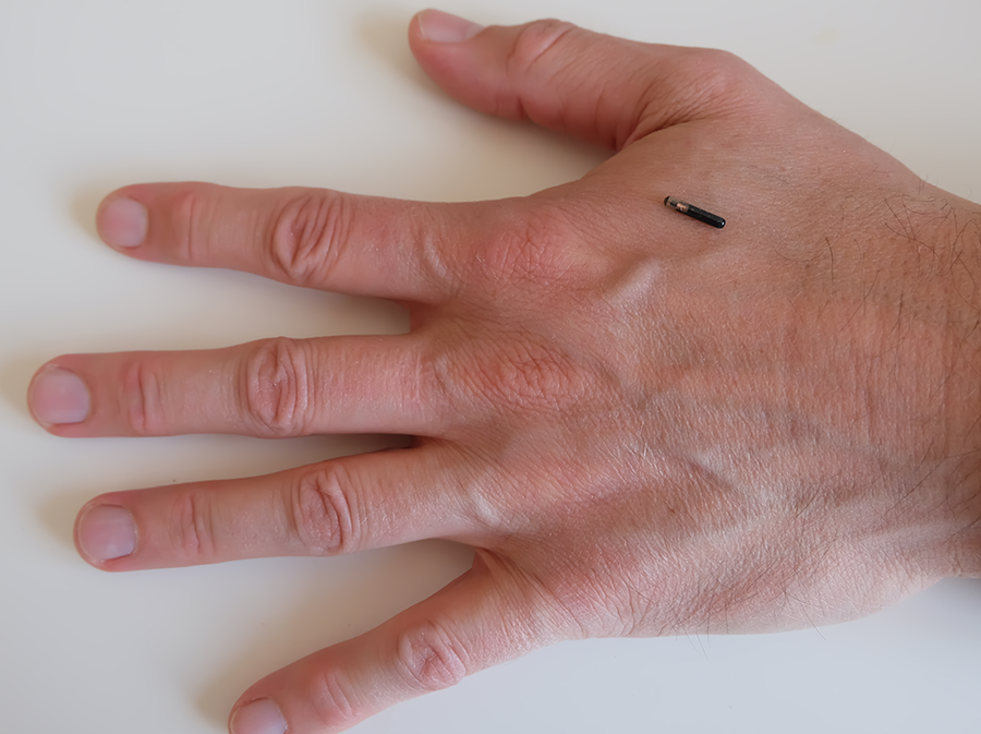 De transponderchip wordt onder de huid geplaatst.
